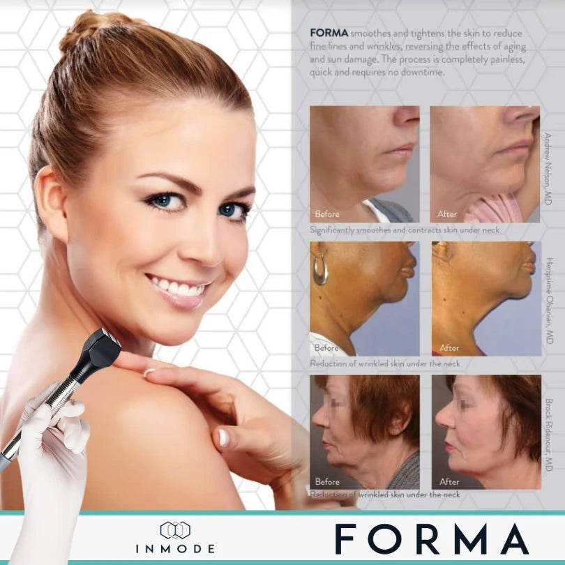 Forma by InMode: Neck